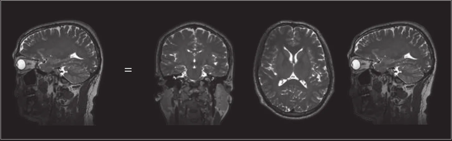 MATRIX brain MRI - one 3D acquisition reconstructed in sagittal, coronal and axial planes